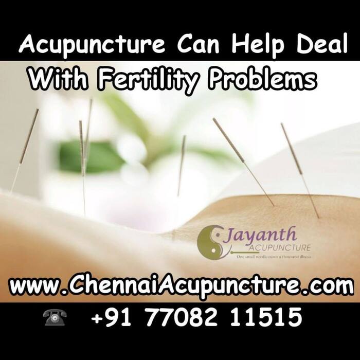 Acupuncture Treatment For Natural Fertility in Chennai - IVF IUI Support Acupuncture Specialist in Chennai Acupuncture Treatment of Chennai Jayanth Acupuncture Clinic #77, Harrington Road, Chetpet - Photo 31 of 42 Acupuncture Treatment For Natural Fertility in Chennai - IVF IUI Support Acupuncture Specialist in Chennai Acupuncture Treatment of Chennai Jayanth Acupuncture Clinic #77, Harrington Road, Chetpet - Photo 31 of 42