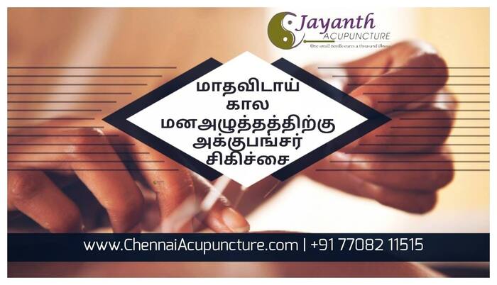 Acupuncture Treatment For Dismenorhea in Chennai Acupuncture Treatment of Chennai Jayanth Acupuncture Clinic #77, Harrington Road, Chetpet - Photo 35 of 42