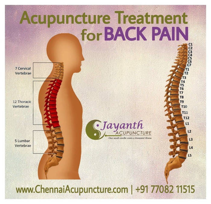 Acupuncture Treatment For Back Pain In Chennai Acupuncture Treatment of Chennai Jayanth Acupuncture Clinic #77, Harrington Road, Chetpet - Photo 39 of 42