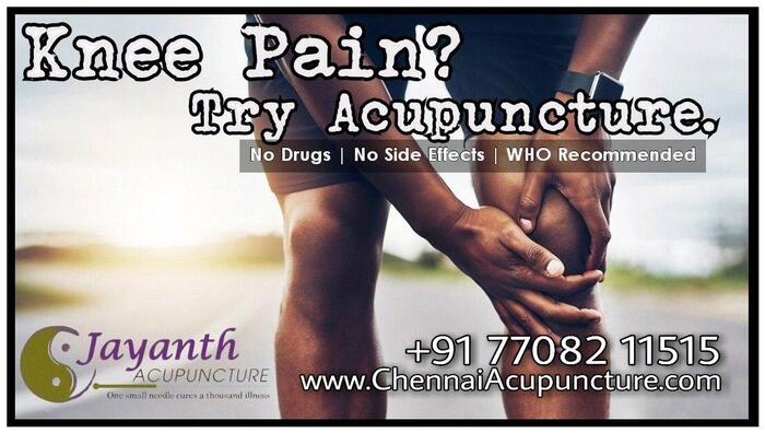 Acupuncture TReatment For Kneepain in Chennai - Arthritis Acupuncture Treatment of Chennai Jayanth Acupuncture Clinic #77, Harrington Road, Chetpet - Photo 1 of 42