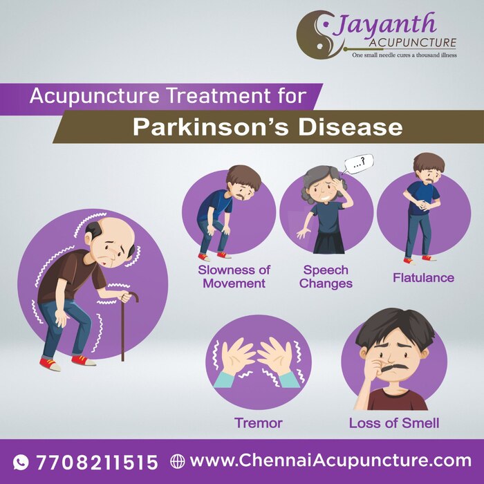 Acupuncture Treatment For Parkinsons Disease in Chennai Acupuncture Treatment of Chennai Jayanth Acupuncture Clinic #77, Harrington Road, Chetpet - Photo 21 of 42 Acupuncture Treatment For Parkinsons Disease in Chennai Acupuncture Treatment of Chennai Jayanth Acupuncture Clinic #77, Harrington Road, Chetpet - Photo 21 of 42