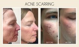  Junto Skin & Laser 1515 E Cedar Ave. Suite C-1, 