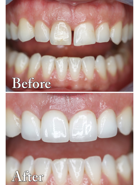  Profile Photos of Bhandari Dental 2525 Old Bronte Rd Suite #470 - Photo 6 of 8