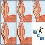 BMI Surgical Institute, Roswell