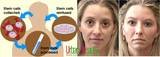 Urban Beauty Thailand - Cosmetic Surgery Thailand Fat Removal Bangkok, bangkok