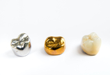 3 types of dental crowns offered by Dentistry At The Grove<br />
 Dentistry at The Grove 2142 Mountain Grove Ave 