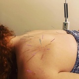  Morningside Acupuncture 900 West End Ave Suite 1C 