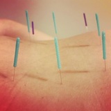  Morningside Acupuncture 900 West End Ave Suite 1C 