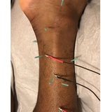 Morningside Acupuncture 900 West End Ave Suite 1C 