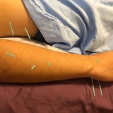 Morningside Acupuncture 900 West End Ave Suite 1C 