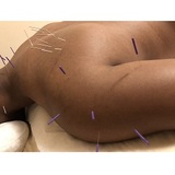  Morningside Acupuncture 900 West End Ave Suite 1C 