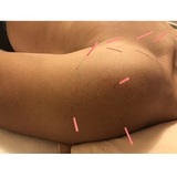  Morningside Acupuncture 900 West End Ave Suite 1C 