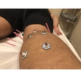  Morningside Acupuncture 900 West End Ave Suite 1C 