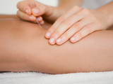  Annie Gaudette acupuncture 206 Boulevard du Fort-Saint-Louis 