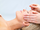 Annie Gaudette acupuncture, Boucherville
