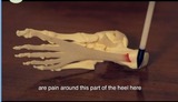 Sydney Heel Pain, North Parramatta