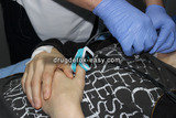 Quick and painless Drug rehab  Easy detox hospital Sremskih boraca 2e 