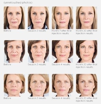 Balshi Dermatology and Cosmetic Surgery Profile Photos of Balshi Dermatology and Cosmetic Surgery 4665 W. Atlantic Ave, Suite B - Photo 6 of 20