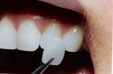 HIMALAYA DENTAL CARE, NANGAL