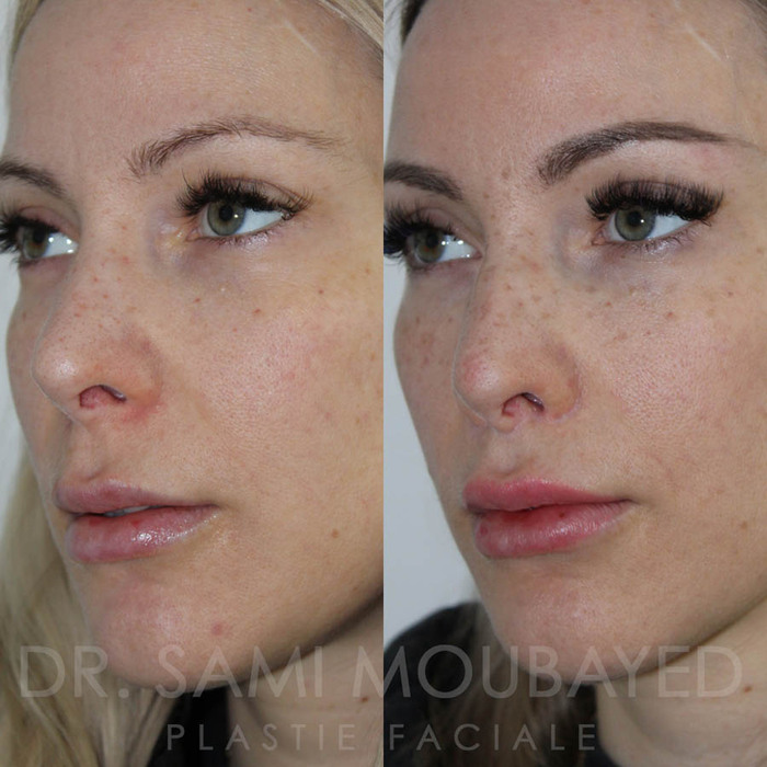  Facelift Montreal of Clinique Face MD 245 Victoria Ave Suite 10 - Photo 5 of 12