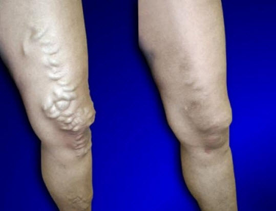  Profile Photos of USA Vein Clinics 225C N Moorpark Rd - Photo 2 of 6