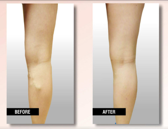  Profile Photos of USA Vein Clinics 225C N Moorpark Rd - Photo 4 of 6