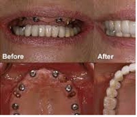  New Album of The Dental Venue Multispeciality Hospital F 14, First Floor Deepthi Apartments Beside St.Anns High School,S.P.Road - Photo 3 of 7