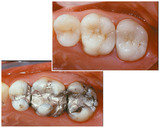  The Dental Venue Multispeciality Hospital F 14, First Floor Deepthi Apartments Beside St.Anns High School,S.P.Road 
