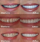  The Dental Venue Multispeciality Hospital F 14, First Floor Deepthi Apartments Beside St.Anns High School,S.P.Road 