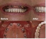  The Dental Venue Multispeciality Hospital F 14, First Floor Deepthi Apartments Beside St.Anns High School,S.P.Road 