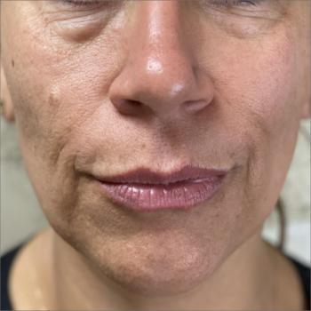  Profile Photos of Integracare Medical Care and Aesthetics 158 N 590 E Vineyard - Photo 3 of 4