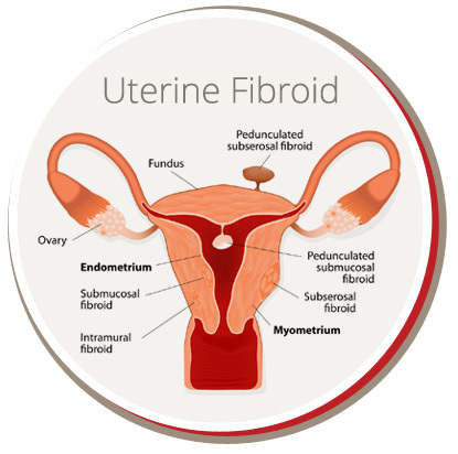  Profile Photos of USA FIbroid Centers 864 Pennsylvania Ave - Photo 5 of 5