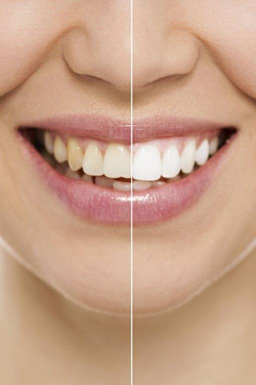  Profile Photos of Palisades Dental - American Fork, UT Dentist 576 Pacific Drive - Photo 1 of 4