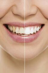Palisades Dental - American Fork, UT Dentist, American Fork
