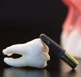 Denver Restorative Dentistry, Westminster