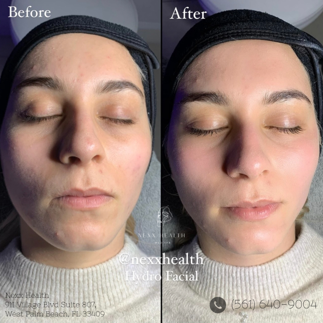  New Album of Nexx Health 911 Village Blvd Suite 807 - Photo 7 of 11