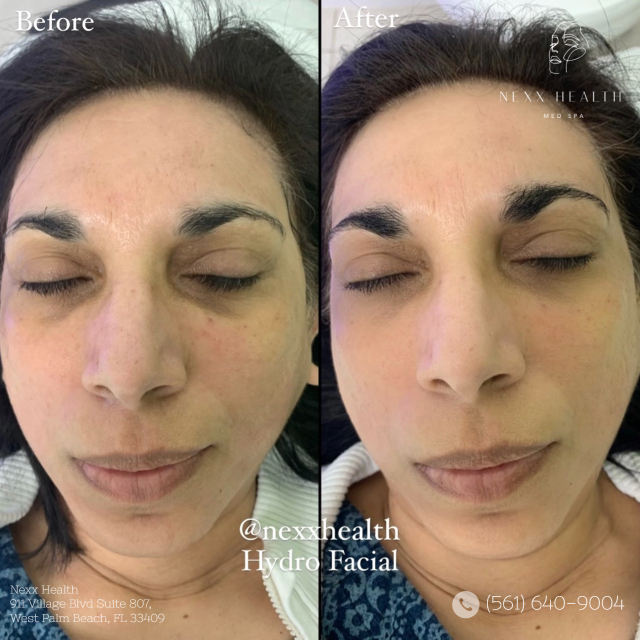  New Album of Nexx Health 911 Village Blvd Suite 807 - Photo 10 of 11