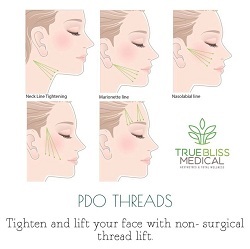  New Album of True Bliss Medical Aesthetics and Wellness 96 Pompton Ave Suite 102 - Photo 1 of 1