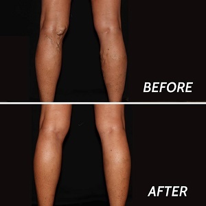  Profile Photos of Vein Doctor Paramus 67c E Ridgewood Ave - Photo 3 of 8