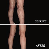 Vein Doctor Paramus, Paramus