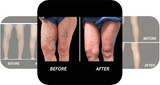 Vein Doctor Paramus, Paramus