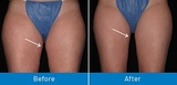 Vein Doctor Paramus, Paramus