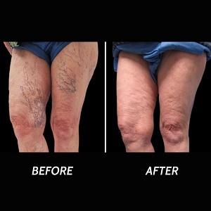  Profile Photos of Varicose Veins Paramus 205 Robin Road, Suite 333-BNM - Photo 2 of 8
