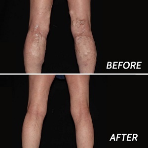  Profile Photos of Varicose Veins Paramus 205 Robin Road, Suite 333-BNM - Photo 4 of 8