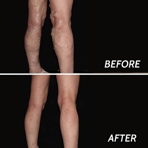  Profile Photos of Varicose Veins Paramus 205 Robin Road, Suite 333-BNM - Photo 5 of 8