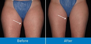  Profile Photos of Varicose Veins Paramus 205 Robin Road, Suite 333-BNM - Photo 6 of 8