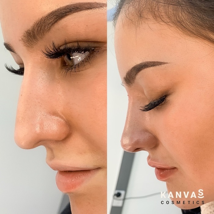  Our Work of Kanvas Cosmetics Centurion House, Staffordshire Technology Park, 27 Anson Court - Photo 2 of 2