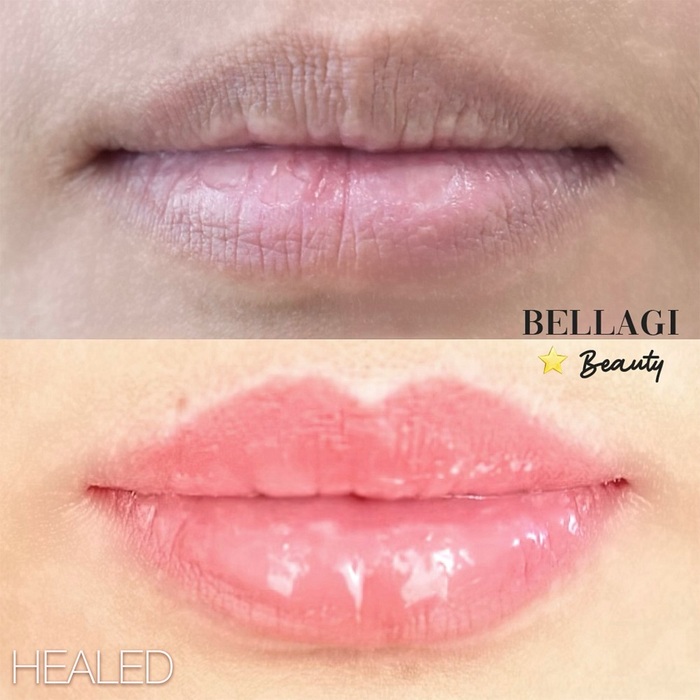  New Album of Bellagi Beauty - Vancouver Microblading, Lip Blush, Eyeliner 550 W Broadway, Unit 527 - Photo 8 of 9