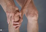 Arthritis & Sports, Sterling