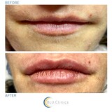 BLU Clinics, London